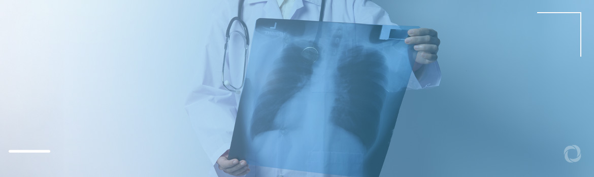 TB returns as top killer disease